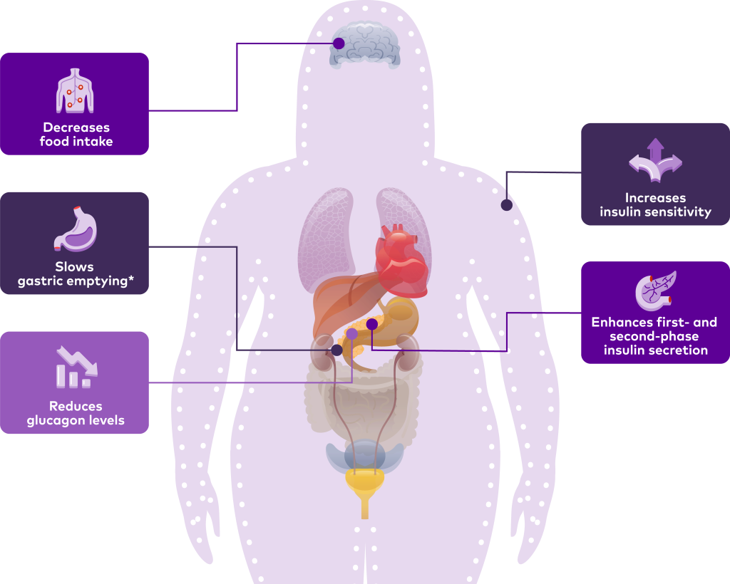 Diagram showing the effects of obesity on various body systems and organs.